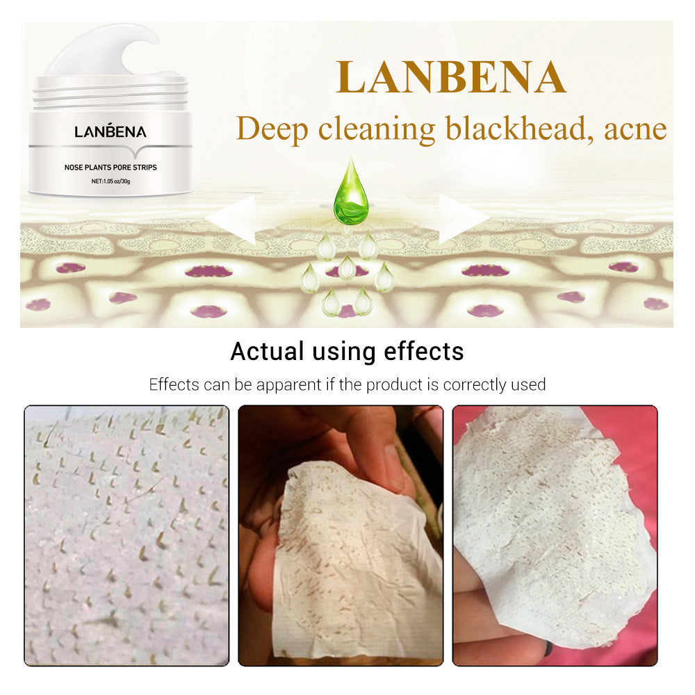 Blackhead Nasal Membrane Sucking Blackhead Tearing To Remove Acne ARVASHAA