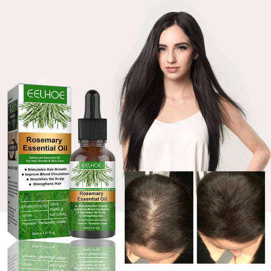 Rosemary Anti-Breakage Nourishing Hair Care Oil ARVASHAA